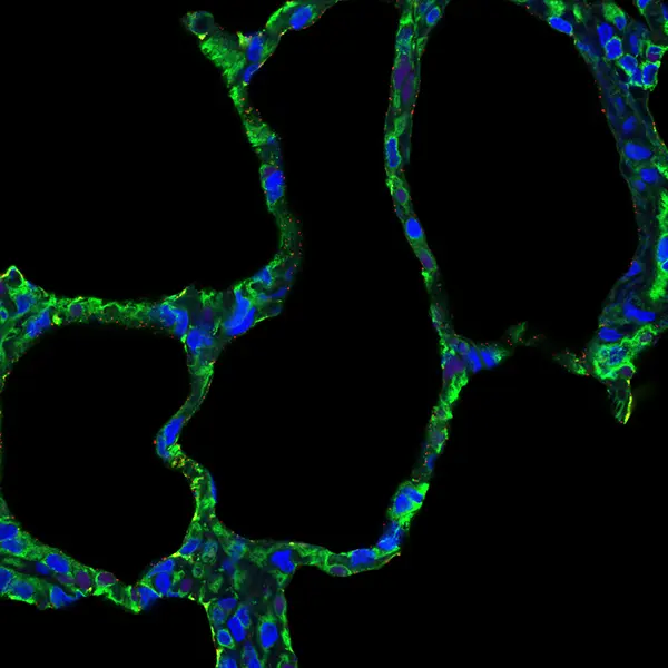SNA H5 Bovine Lung-alveoli